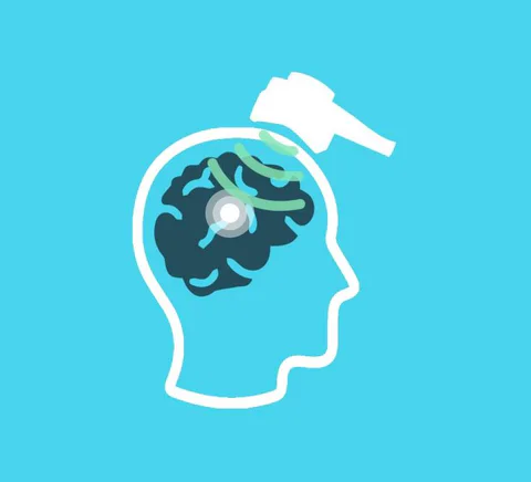 Illustration of a head and a magnetic stimulation device.